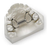 Fixed Palate Expander