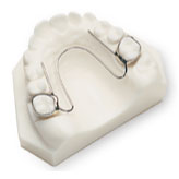 Fixed Palate Expander